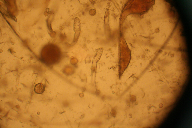 Ácaro subcutáneo bajo el objetivo del microscopio