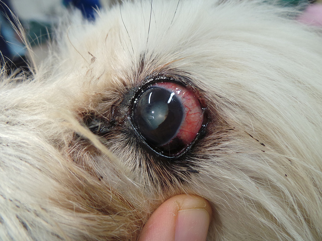 Glaucoma