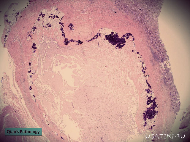 Microscopía de tejidos