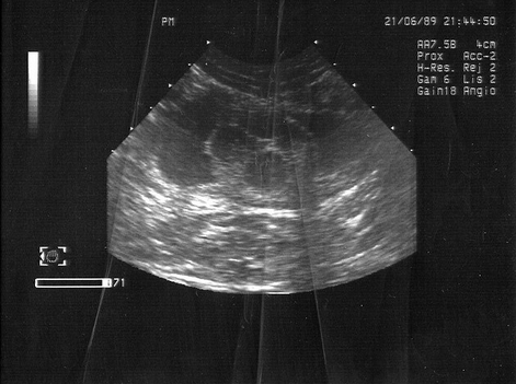 Una ecografía de los órganos abdominales ayudará a diagnosticar la cistitis en el gato