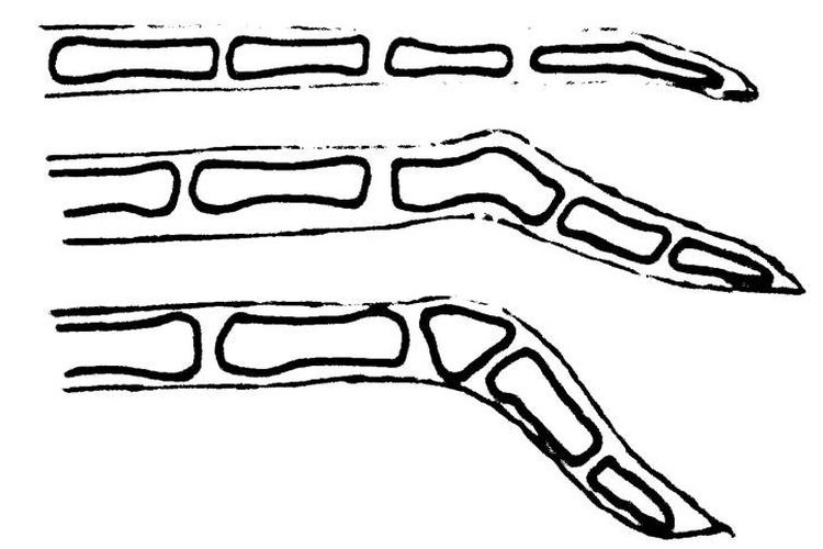 Representación esquemática de las fracturas de cola
