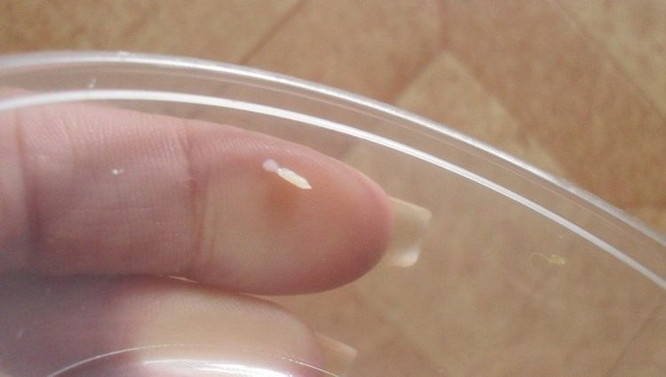 Foto de la larva de la tenia del pepino
