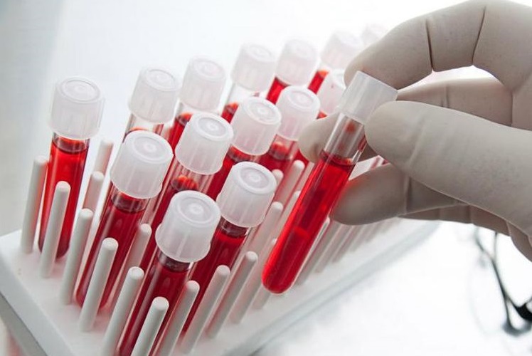 Tubos de sangre