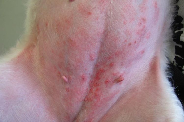 Marcas de picaduras de pulgas
