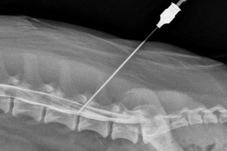 Radiografía de la columna vertebral