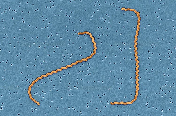 Leptospira interrogans