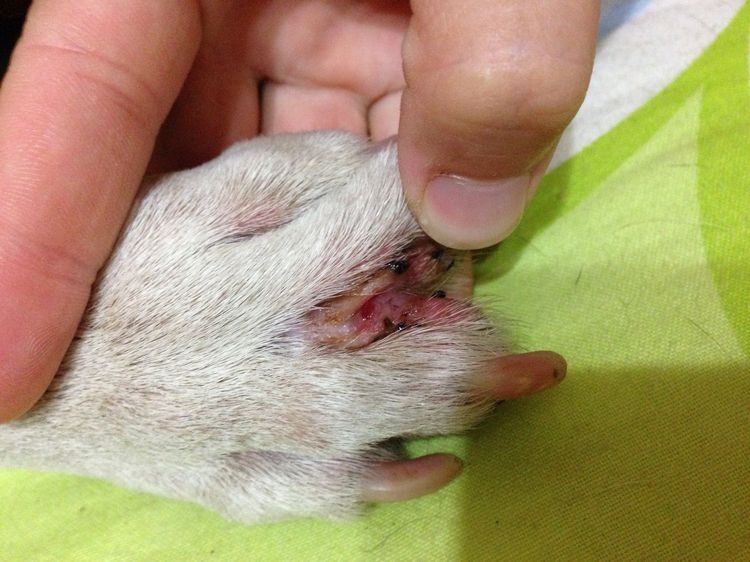 Dermatitis interdigital