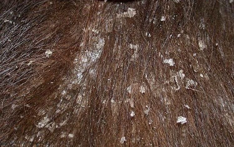 Cheiletiosis en perros