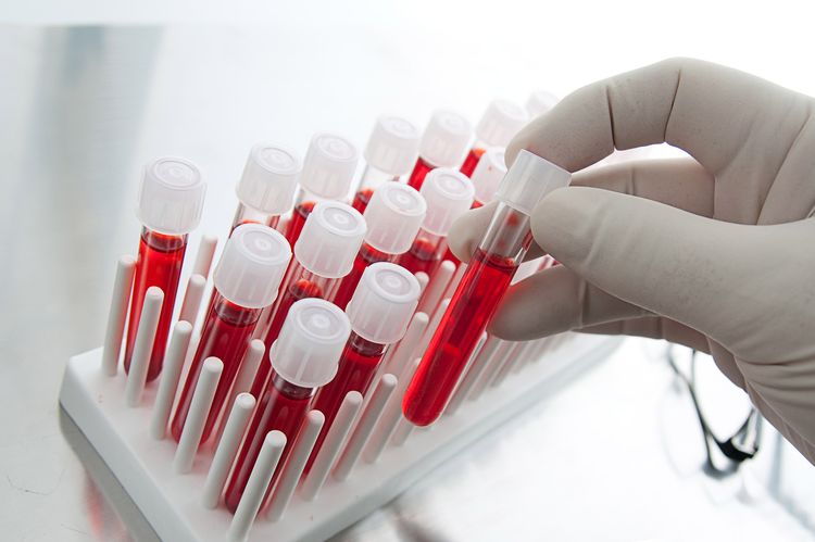 Análisis de sangre para herpes en perro