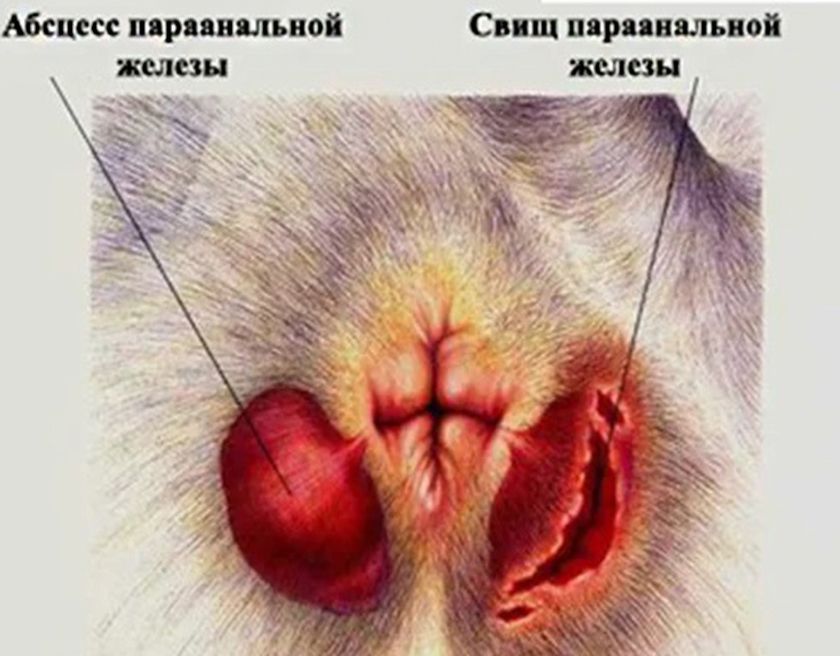 Absceso y fístula