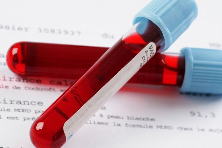 Análisis de sangre para clamidiosis