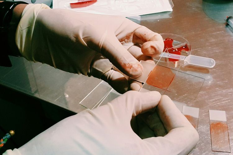 Análisis en el laboratorio