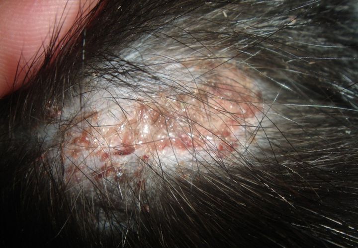 Tricofitosis en el perro