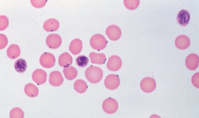 Micoplasmas (Mycoplasma)