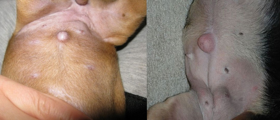 Causas de la hernia umbilical