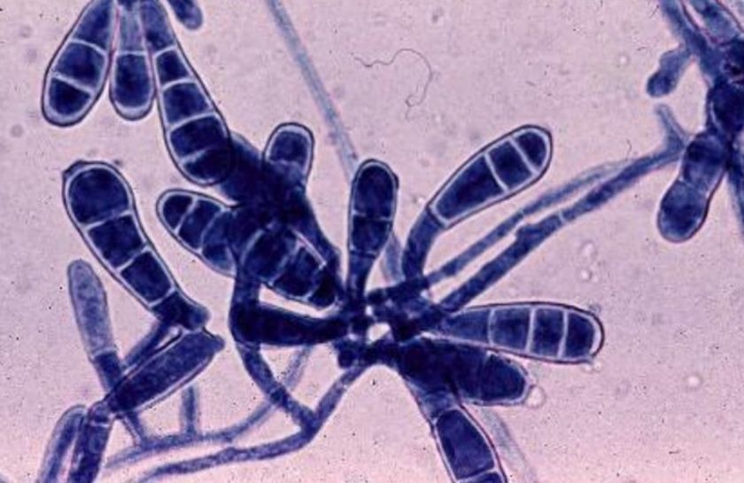 Agente causal de la dermatofitosis