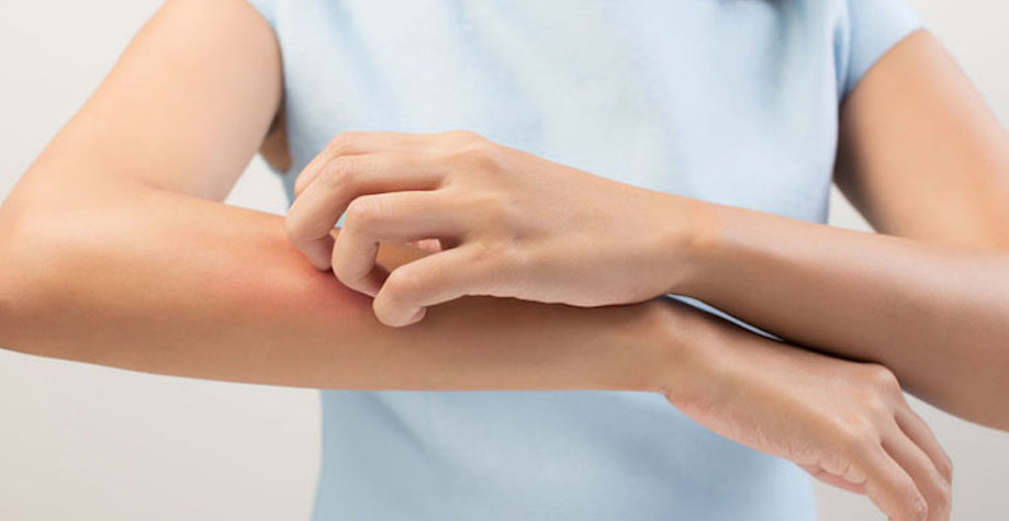 ¿Se da la sarcoptosis en humanos?